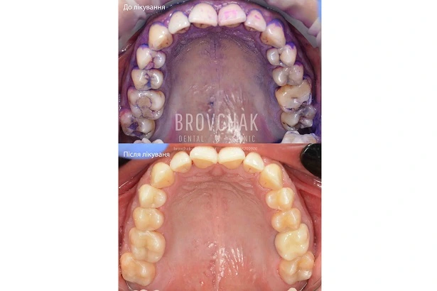 Dentistry «Brovchak Family Dental Care» on Dimeevskaya (Brovchak Family Dental Clinic)
