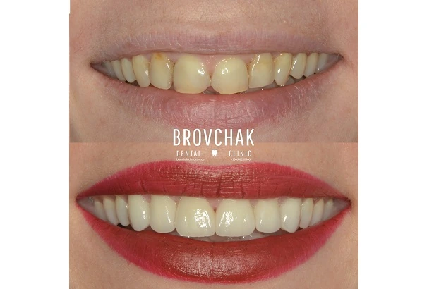 Dentistry «Brovchak Family Dental Care» on Dimeevskaya (Brovchak Family Dental Clinic)