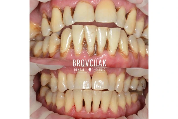 Стоматологія «Brovchak Dental Clinic» (Бровчак Дентал Клінік)