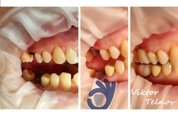 Стоматологія «Good Dental»  (Гудд Дентал)