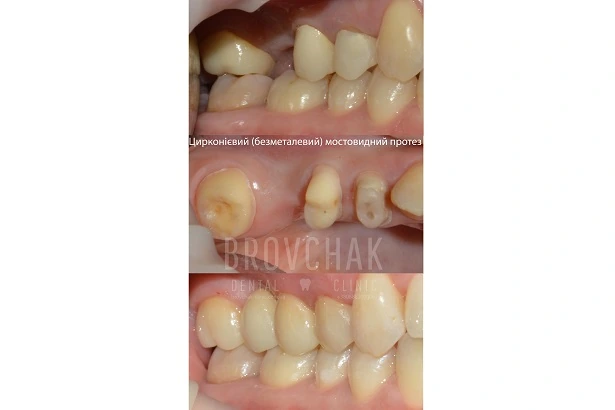 Стоматологія «Brovchak Dental Clinic» (Бровчак Дентал Клінік)