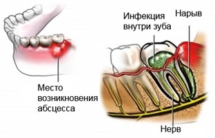 Причины образования флюса