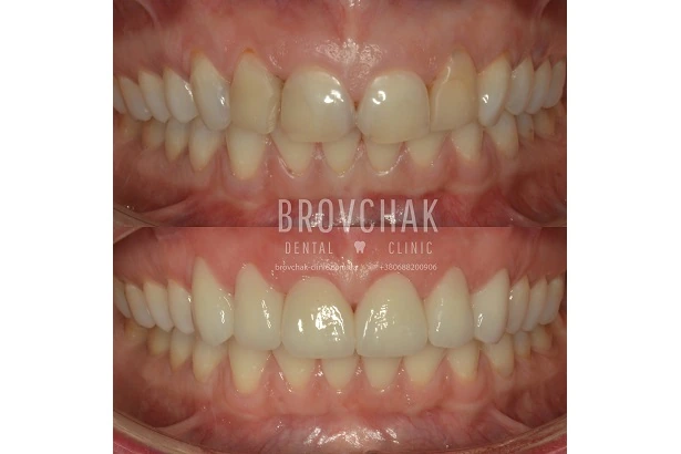 Dentistry «Brovchak Family Dental Care» on Dimeevskaya (Brovchak Family Dental Clinic)