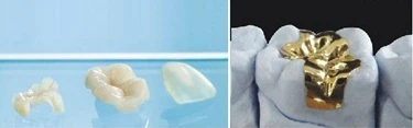 Microprosthetics микропротезирование киев