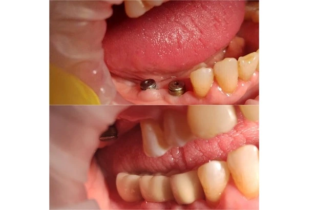 Стоматологія «Good Dental»  (Гудд Дентал)