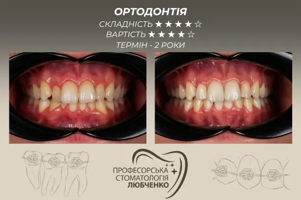 Стоматологія «Професорська стоматологія Любченко»